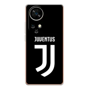 Чехлы для Ulefone Note 17 Pro (VPrint) - Футбольные клубы (ФК Ювентус)