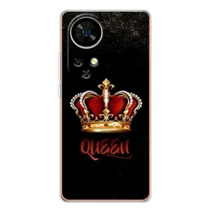Чехол с принтом «Корона короля» для Ulefone Note 17 Pro