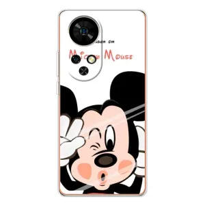 Эксклюзивный чехол для Ulefone Note 17 Pro (AlphaPrint - Мультяшные) (Маус Микки)