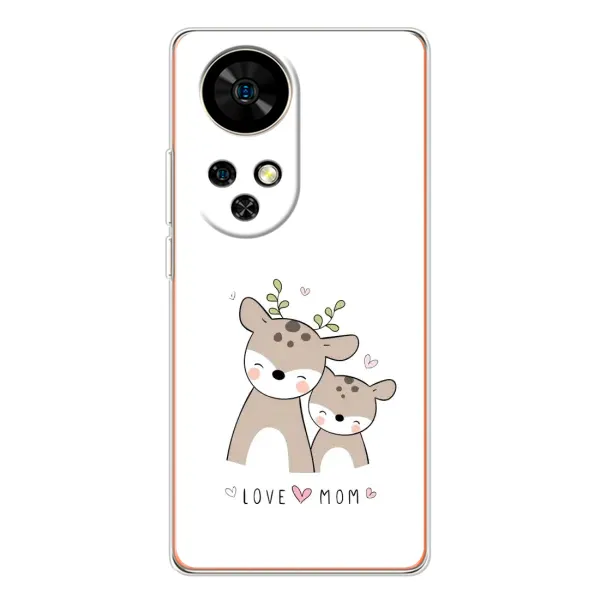 Чехол с принтом «Оленята мама и малыш» для Ulefone Note 17 Pro Чехол с принтом «Оленята мама и малыш» для Ulefone Note 17 Pro