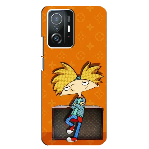Чехол с принтом «Арнольд» для Xiaomi 11T / 11T Pro Чехол с принтом «Арнольд» для Xiaomi 11T / 11T Pro