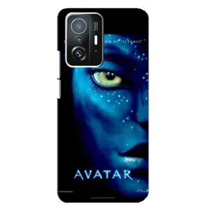Чехол с принтом «глаз Аватара» для Xiaomi 11T / 11T Pro