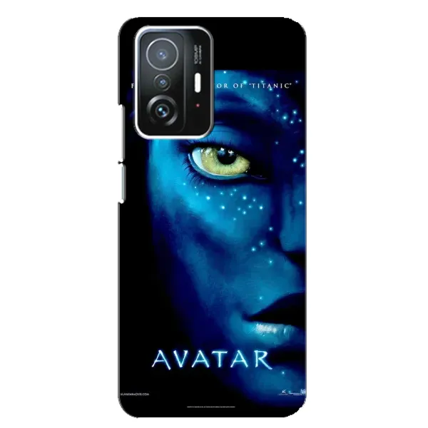 Чехол с принтом «глаз Аватара» для Xiaomi 11T / 11T Pro
