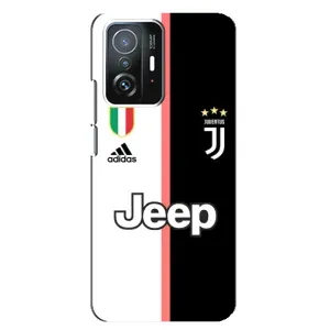 Чохли для Xiaomi 11T / 11T Pro (VPrint) - Футбольні клуби (Juventus)