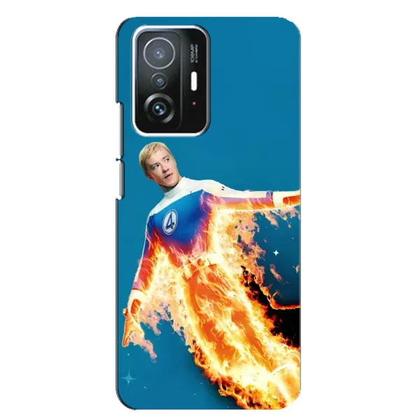 Чехол с принтом «Человек-факел в огне» для Xiaomi 11T / 11T Pro Чехол с принтом «Человек-факел в огне» для Xiaomi 11T / 11T Pro
