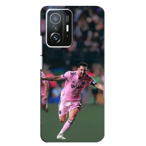 Чехол с принтом «Месямба» для Xiaomi 11T / 11T Pro Чехол с принтом «Месямба» для Xiaomi 11T / 11T Pro