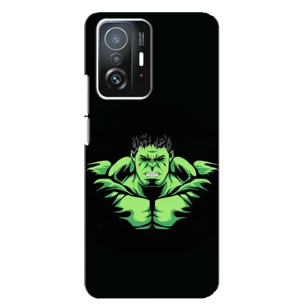 Чохол з принтом «Зелений Халк» для Xiaomi 11T / 11T Pro Чохол з принтом «Зелений Халк» для Xiaomi 11T / 11T Pro
