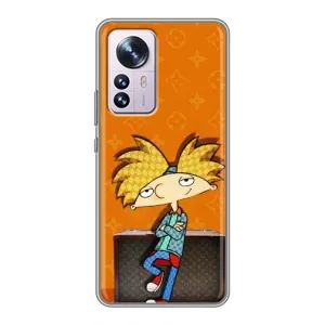 Чехол с принтом «Арнольд» для Xiaomi 12 / 12X