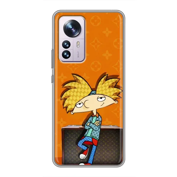 Чехол с принтом «Арнольд» для Xiaomi 12 / 12X Чехол с принтом «Арнольд» для Xiaomi 12 / 12X