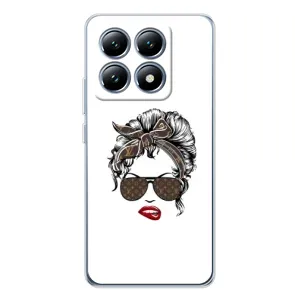 Чехлы Луи Витон для Xiaomi 14T Pro (AlphaPrint - LOUIS VUITTON) (стильная с луи витон)