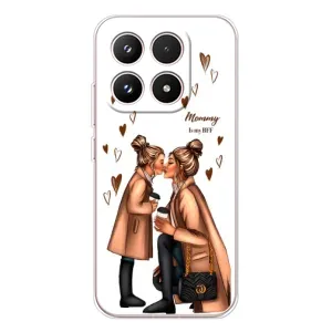 Чехол с печатью для Xiaomi 17 - (Мама с ребенком) (AlphaPrint)