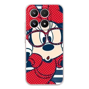 Эксклюзивный чехол для Xiaomi 17 (AlphaPrint - Мультяшные) (Маус в очках)
