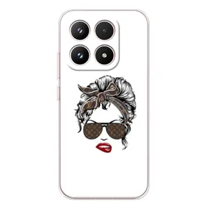 Чехлы Луи Витон для Xiaomi 17 (AlphaPrint - LOUIS VUITTON) (стильная с луи витон)