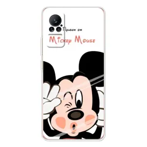 Эксклюзивный чехол для Xiaomi Civi 1S (AlphaPrint - Мультяшные) (Маус Микки)