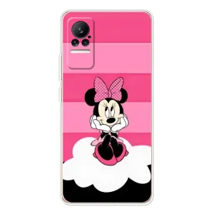 Эксклюзивный чехол для Xiaomi Civi (AlphaPrint - Мультяшные) (Девочка Maus)