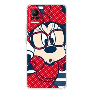 Эксклюзивный чехол для Xiaomi Civi (AlphaPrint - Мультяшные) (Маус в очках)