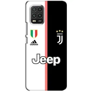 Чохли для Xiaomi Mi 10 Lite (VPrint) - Футбольні клуби (Juventus)
