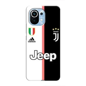 Чохли для Xiaomi Mi 11 (VPrint) - Футбольні клуби (Juventus)