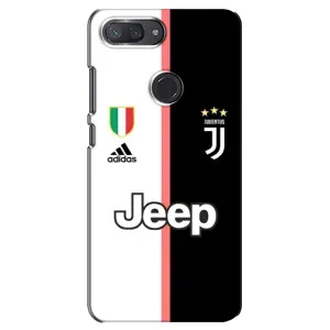 Чохли для Xiaomi Mi 8 Lite (VPrint) - Футбольні клуби (Juventus)