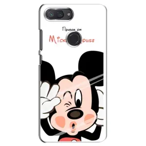 Эксклюзивный чехол для Xiaomi Mi 8 Lite (AlphaPrint - Мультяшные) (Маус Микки)