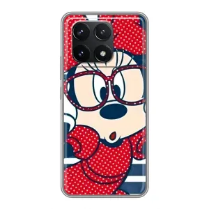 Эксклюзивный чехол для Xiaomi POCO F6 Pro (AlphaPrint - Мультяшные) (Маус в очках)