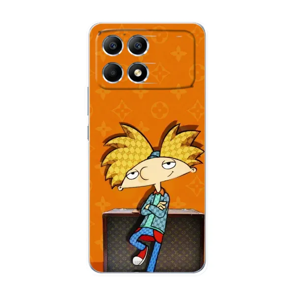 Чехол с принтом «Арнольд» для Xiaomi POCO F6 Чехол с принтом «Арнольд» для Xiaomi POCO F6