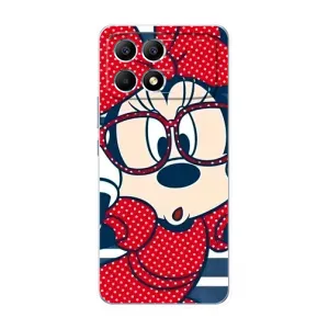 Міккі Маус чохол для Xiaomi POCO F6 (AlphaPrint - Мультяшні) (Маус в окулярах)