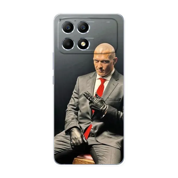 Чохол з принтом «Усик Hitman» для Xiaomi POCO F6 Чохол з принтом «Усик Hitman» для Xiaomi POCO F6