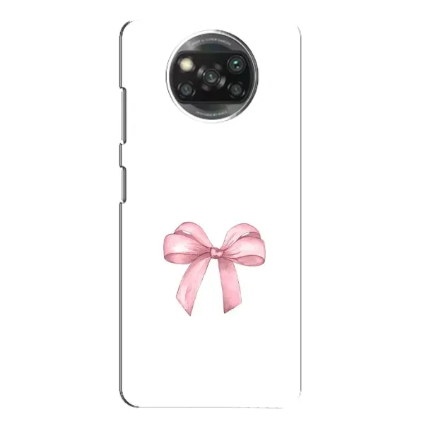 Чехол с принтом «Бант дизайн» для Xiaomi POCO X3 Чехол с принтом «Бант дизайн» для Xiaomi POCO X3