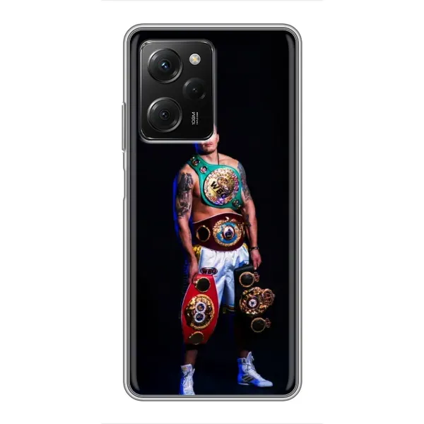 Чехол с принтом «Усик с поясами» для Xiaomi POCO X5 Pro (5G) Чехол с принтом «Усик с поясами» для Xiaomi POCO X5 Pro (5G)
