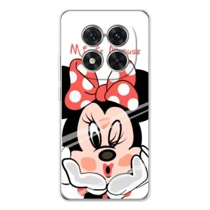 Эксклюзивный чехол для Xiaomi POCO X7 (AlphaPrint - Мультяшные) (Маус Минни)