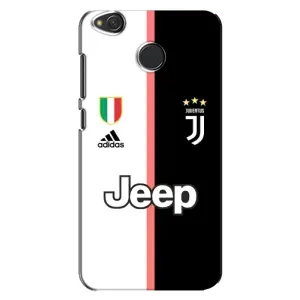 Чехлы для Xiaomi Redmi 4X (VPrint) - Футбольные клубы (Juventus)