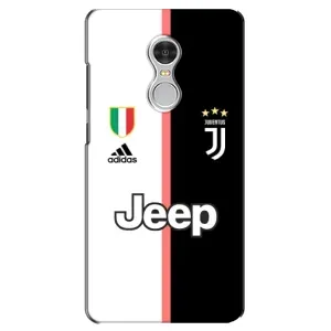 Чехлы для Xiaomi Redmi 5 (VPrint) - Футбольные клубы (Juventus)