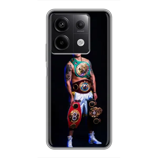Чохол з принтом «Усик з поясами» для Xiaomi Redmi Note 13 (5G) Чохол з принтом «Усик з поясами» для Xiaomi Redmi Note 13 (5G)