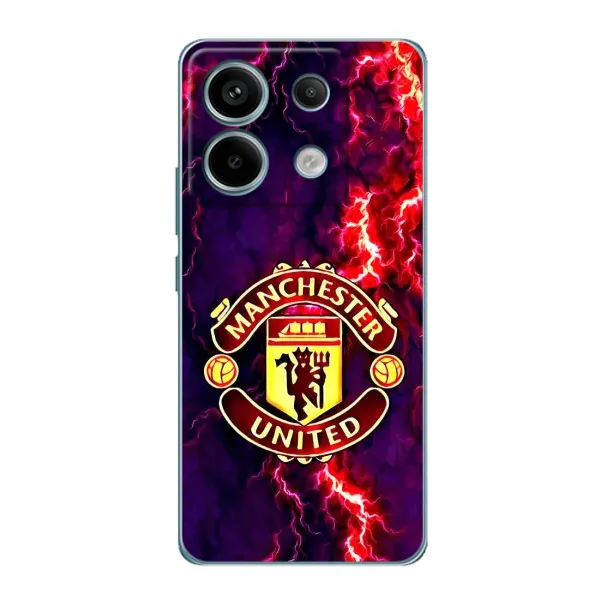 Чохол з принтом «вогняний Манчестер» для Xiaomi Redmi Note 13 Pro (5G) Чохол з принтом «вогняний Манчестер» для Xiaomi Redmi Note 13 Pro (5G)