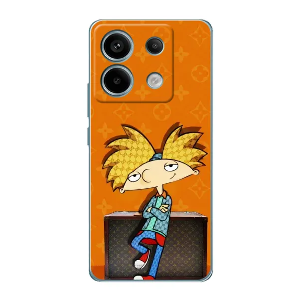 Чехол с принтом «Арнольд» для Xiaomi Redmi Note 13 Pro Чехол с принтом «Арнольд» для Xiaomi Redmi Note 13 Pro