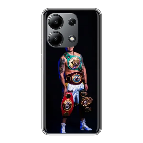 Чохол з принтом «Усик з поясами» для Xiaomi Redmi Note 13 (4G) Чохол з принтом «Усик з поясами» для Xiaomi Redmi Note 13 (4G)