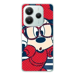 Эксклюзивный чехол для Xiaomi Redmi Note 14 5G (AlphaPrint - Мультяшные) (Маус в очках)