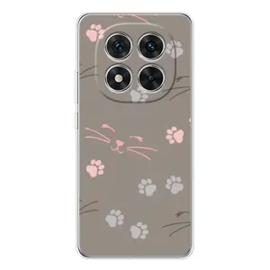 Чохол з малюнком кіт на Xiaomi Redmi Note 14 Pro Plus (Лапи і вуса)
