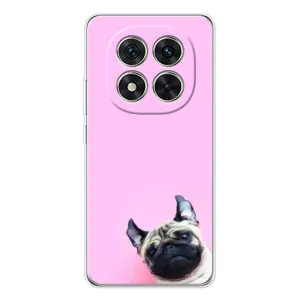 Чохол з принтом «Смішна собака» для Xiaomi Redmi Note 14 Pro Plus