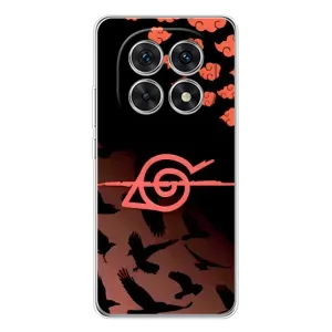 Чохол Ітачи Учіха для Шьомуі Мі Redmi Ноте 15 5G (AlphaPrint) (Око Ітачі)