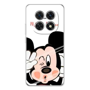 Эксклюзивный чехол для Xiaomi Redmi Note 15 5G (AlphaPrint - Мультяшные) (Маус Микки)