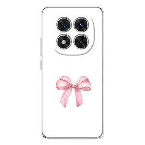 Чехол с бантиками на arbete. redmi нот 15 про 5G (Бант дизайн)