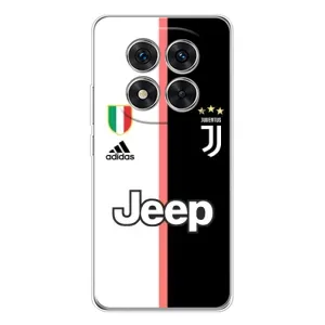 Чохли для Xiaomi Redmi Note 15 Pro Plus (VPrint) - Футбольні клуби (Juventus)
