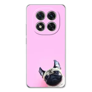 Чехлы с собаками для Xiaomi Redmi Note 15 Pro Plus (VPrint)