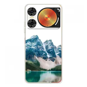 Силиконовый чехол с КАРТИНКАМИ лето для ZTE Nubia Music 2 (AlphaPrint)